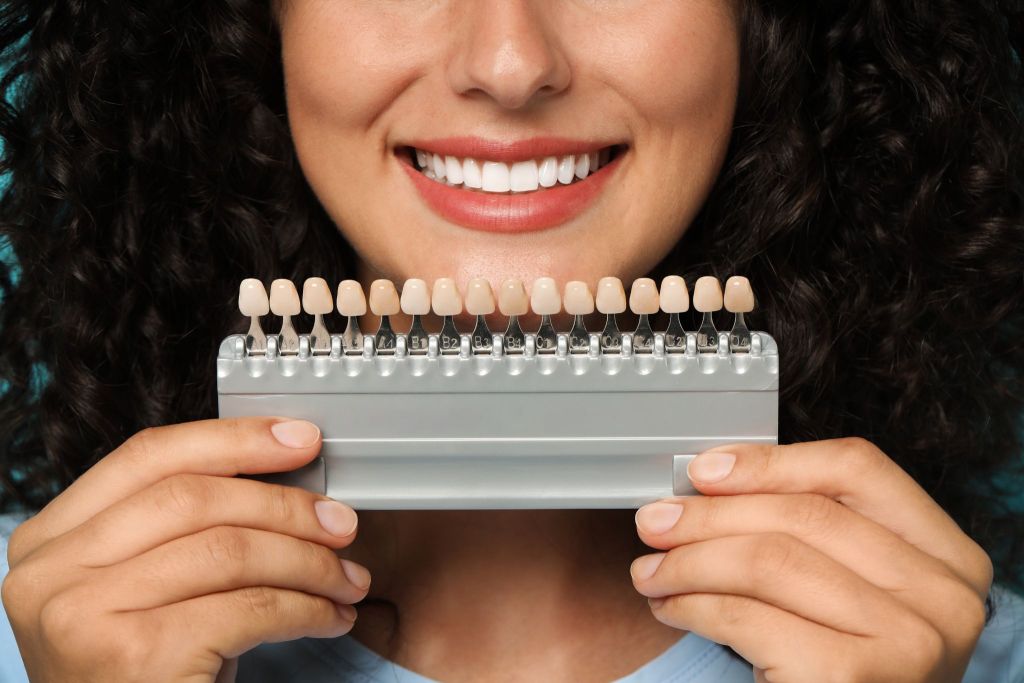 Smile Makeover Bathurst